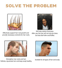 Anti Hair Loss Shampoo Fast Growing Repair Damaged Scalp Dry Frizzy Treatment Deep Nourishment Moisturizing Regrowth Conditioner - BlissFully