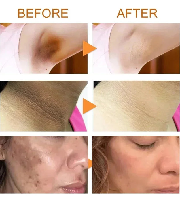 Body Whitening Soap Underarm Knee Bleaching Soap Chicken Skin Removal Dark Spot Removal Dead Skin Moisturize Brighten Body Care