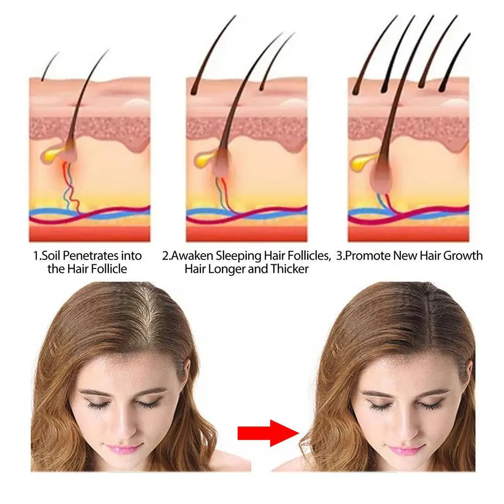 Rosemary Shampoo Soap Ginger/bamboo/lavender/Polygonum Multiflorum Deep Cleansing Soap Bar For Treated Dry Damaged Hair Care - BlissFully