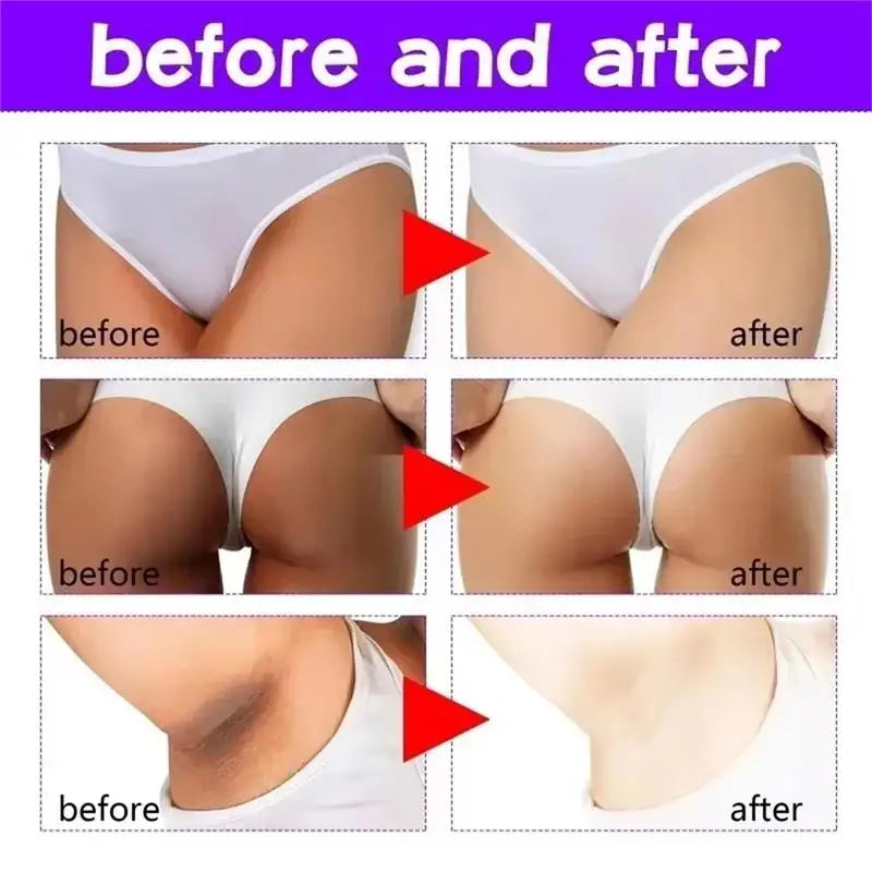 Whitening Body Cream Private Parts Underarm Bleaching Serum Whiten Butt Knee Brighten Inner Thigh Intimate Dark Remove Melanin