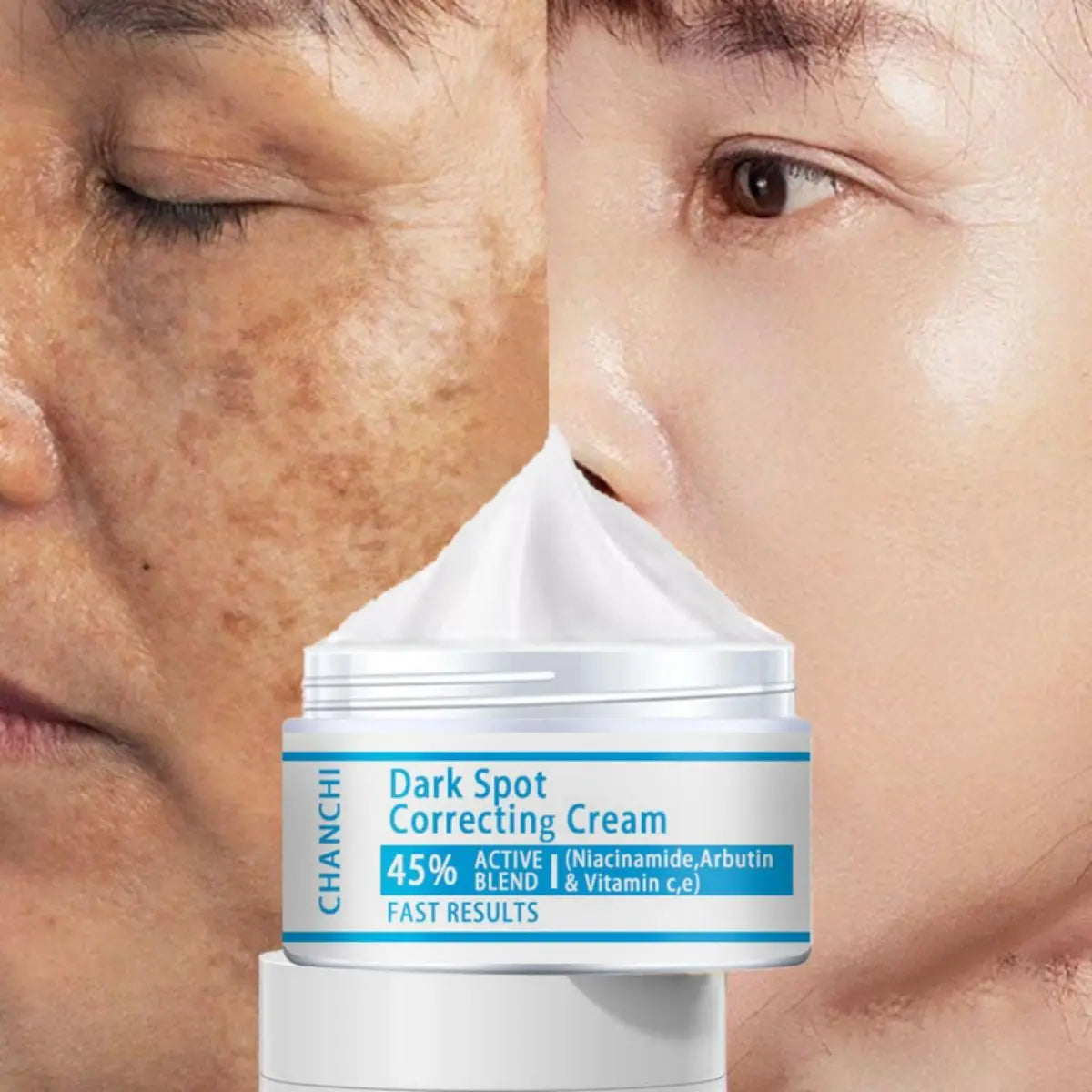 Whitening Freckles Cream Remove Melasma Dark Spot Lightening Melanin Brightening Melasma Remover Moisturize Anti-aging Face Care - BlissFully