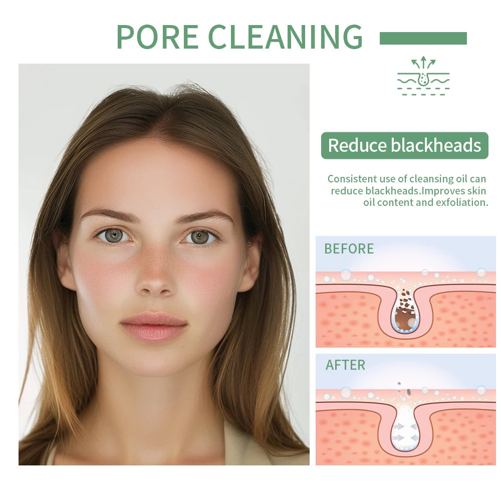 Deeply Cleansing Oil Instant Makeup Removal Refreshing Non Irritating Removal Cleansing Oil Sensitive Skin Care