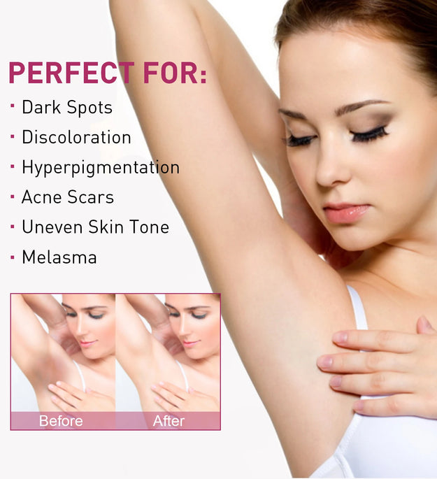 Whitening Cream For Dark Skin Underarm Armpit Thigh Inner Joint Lightening Sensitive Area Body Care Moisturizing Brighten Lotion