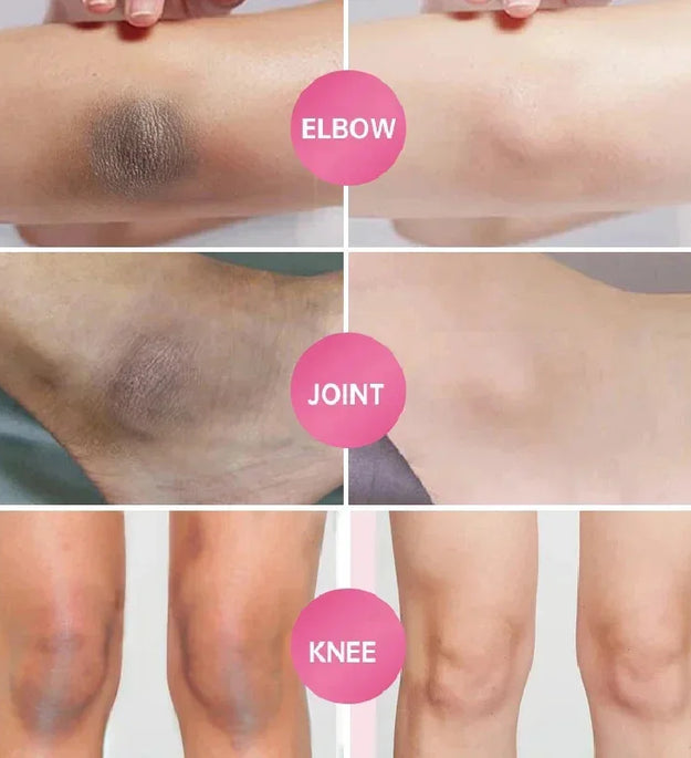 Whitening Cream For Dark Skin Armpit Thigh Inner Joint Lightening Intimate Area Underarm Body Care Private Parts Brighten Lotion