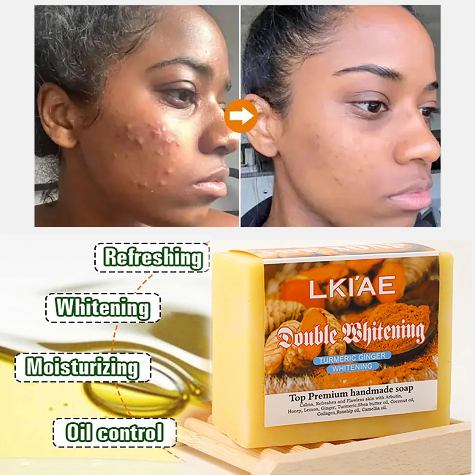 Natural Turmeric Whitening Soap Bar, Reduce Acne, Spots, Moisturize and Smoothen Skin, With Honey, Glycerin, 150g/5.3 oz