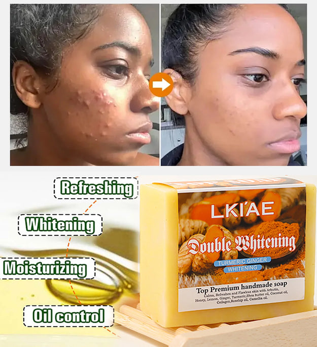 Natural Turmeric Whitening Soap Bar, Reduce Acne, Spots, Moisturize and Smoothen Skin, With Honey, Glycerin, 150g/5.3 oz