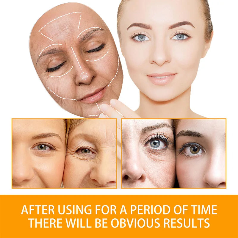 Anti Acne Turmeric Cream, Fades Scars & Dark Spots, for Oily and Dull Skin, Brightening Turmeric Face Care Treatment, 50ml - BlissFully