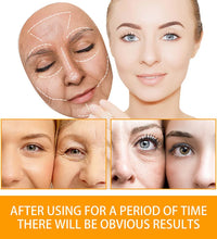 Anti Acne Turmeric Cream, Fades Scars & Dark Spots, for Oily and Dull Skin, Brightening Turmeric Face Care Treatment, 50ml - BlissFully