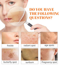 Freckle Whitening Face Cream Papaya Day Night Sun Spots Corrector Fade Pigment Brighten Skin Tone Blemish Bleaching Nourishing - BlissFully