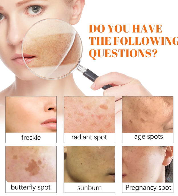 Freckle Whitening Face Cream Papaya Day Night Sun Spots Corrector Fade Pigment Brighten Skin Tone Blemish Bleaching Nourishing - BlissFully