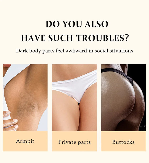 Remove Melanin Body Whitening Snow Bleach Cream Brighten Underarm Elbow Knees Joint Lighten Intimate Part Thigh Inner Dark Spot