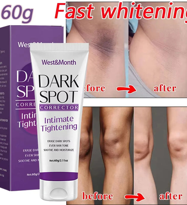 Body Whitening Lotion Dark Spot Remover For Underarms Knees Elbows Melanin Bleaching Lightening Skin Moisturizing Cream 60g