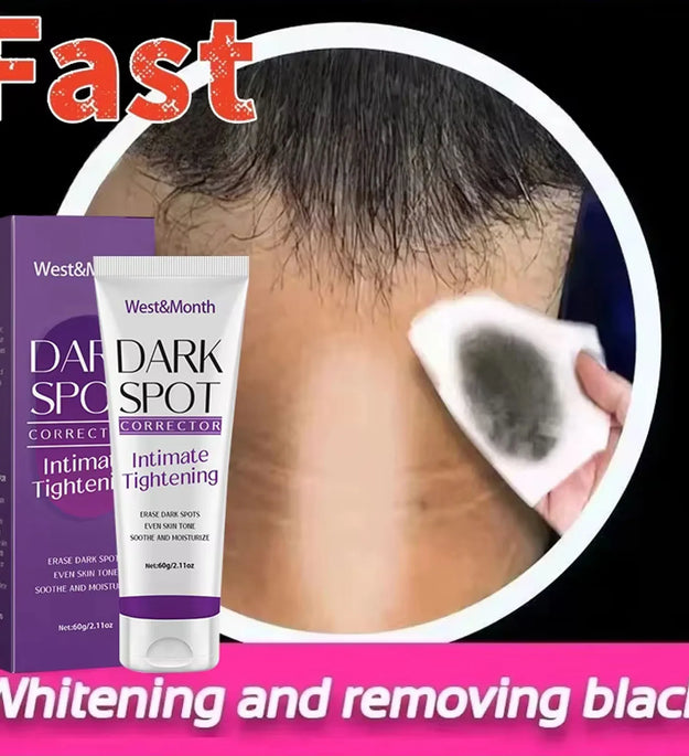 Body Whitening Lotion Dark Spot Remover For Underarms Knees Elbows Melanin Bleaching Lightening Skin Moisturizing Cream 60g