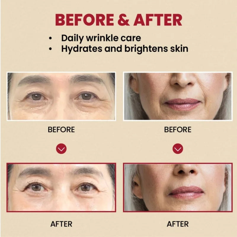 Seoul 1988 Anti-Aging Trio: 4% Retinal Eye Cream + 2% Retinal Serum w/ Black Ginseng for Wrinkles & Brightening,Korean Skincare - BlissFully