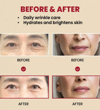 Seoul 1988 Anti-Aging Trio: 4% Retinal Eye Cream + 2% Retinal Serum w/ Black Ginseng for Wrinkles & Brightening,Korean Skincare - BlissFully