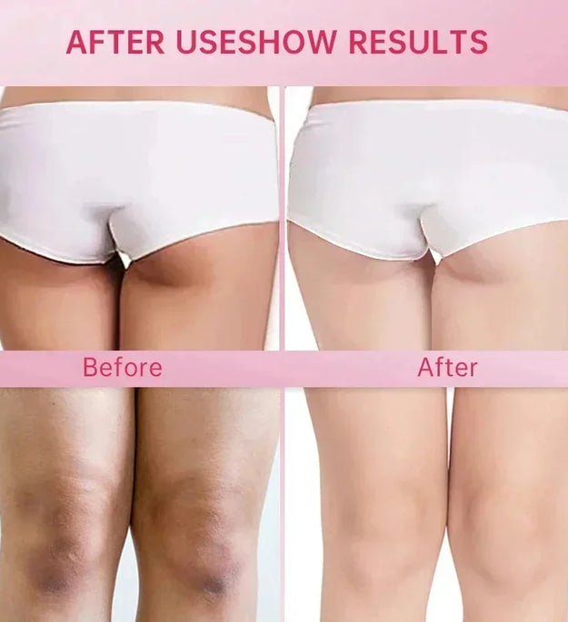 Whitening Serum Cream for Dark Skin Intimate Areas Armpit Private Parts Underarm Lightening Body Cream Skin Care Korea Products