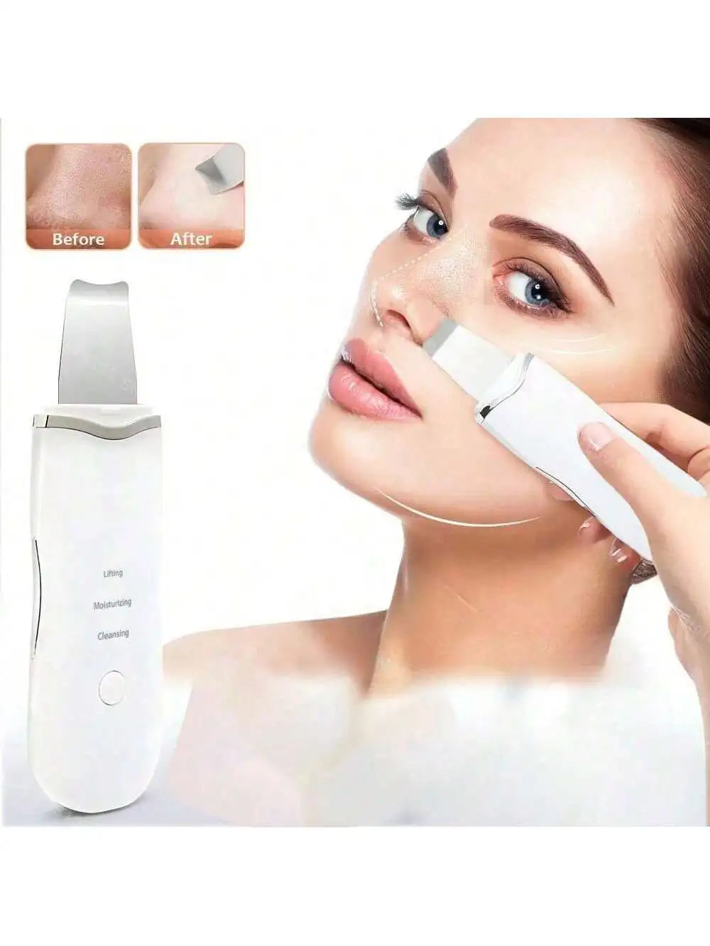 Ultrasonic Skin Scrubber Scrubber Deep Vibrate Facial Cleaner Shovel Face Scrubber Peeling Black Head Remover Facial Massager - BlissFully