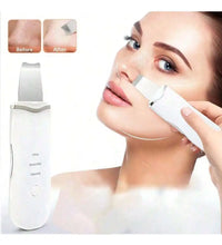 Ultrasonic Skin Scrubber Scrubber Deep Vibrate Facial Cleaner Shovel Face Scrubber Peeling Black Head Remover Facial Massager - BlissFully