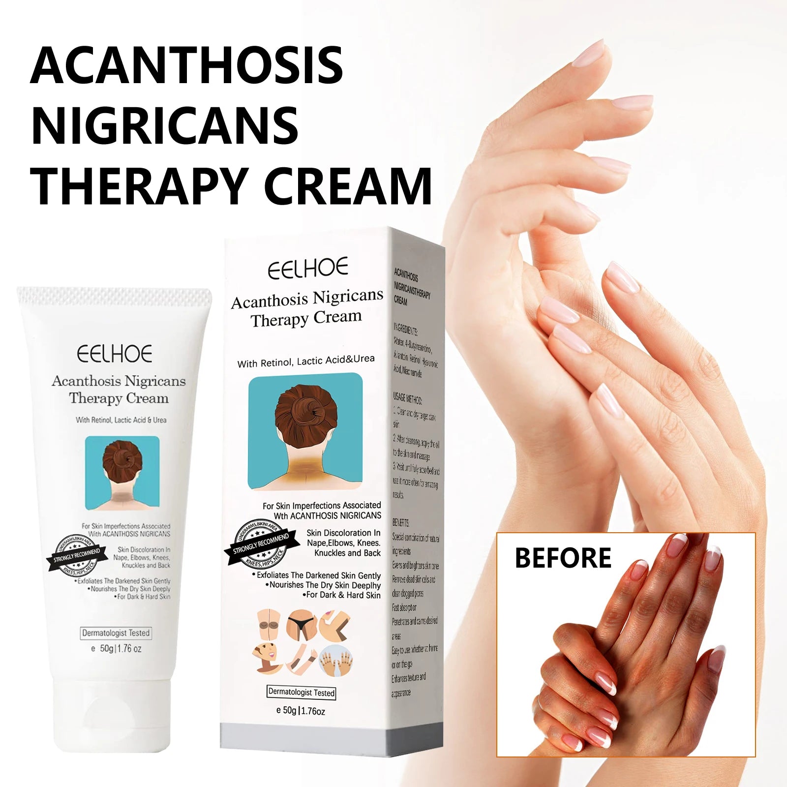 EELHOE Whitening Cream Brightening Skin For Dark Skin Neck Arm Knee Joint Underarm Body Care Acanthosis Nigricans Therapy Cream