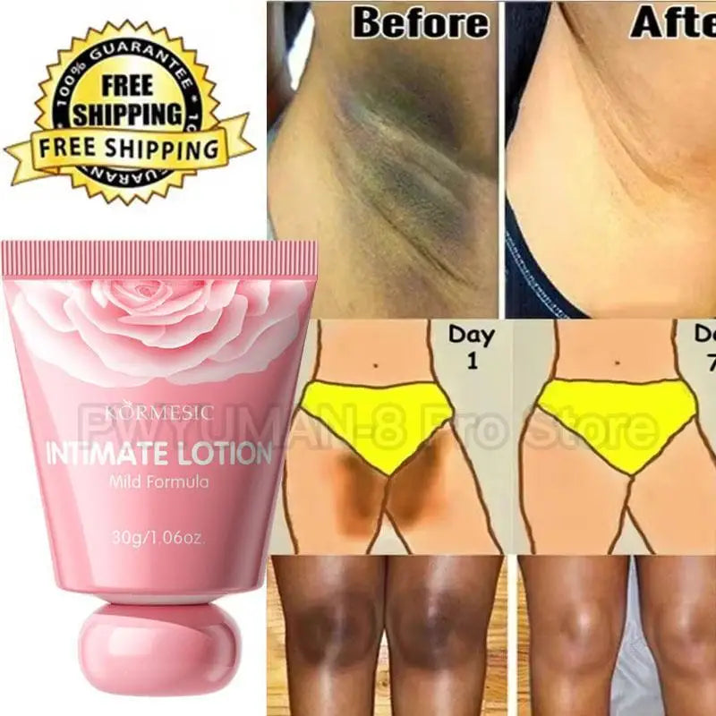 Whitening Cream Private Parts Underarm Bleaching Lotion Whiten Butt Knee Brighten Inner Thigh Intimate Parts Dark Remove Melanin