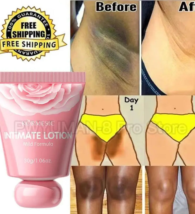 Whitening Cream Private Parts Underarm Bleaching Lotion Whiten Butt Knee Brighten Inner Thigh Intimate Parts Dark Remove Melanin