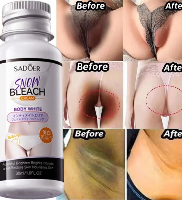 Whitening Cream Private Parts Underarm Bleaching Serum Whiten Butt Knee Brighten Inner Thigh Intimate Parts Dark Remove Melanin