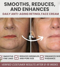 Instant Retinol Cream Wrinkle Remover Firming Lifting Anti Aging Fade Fine Lines Moisturizing Whitening Korea Repair Skin Care - BlissFully