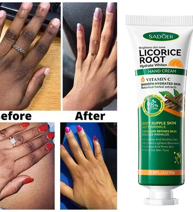 Fast Whitening Dark Knuckles Brighten Hand Cream Melanin Corrector Moisturizing Intense Stains Remover Cosmetics Skin Care 2024