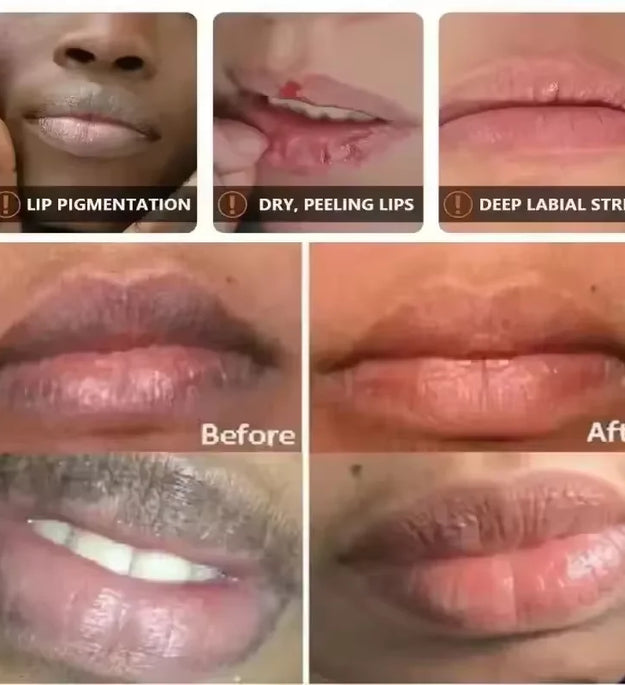 Remove Dark Lip Balm Serum Fast Lighten Melanin Lip Mask Exfoliating Fade Lip Lines Dead Skin Nourishing Repair Lip Care Makeup