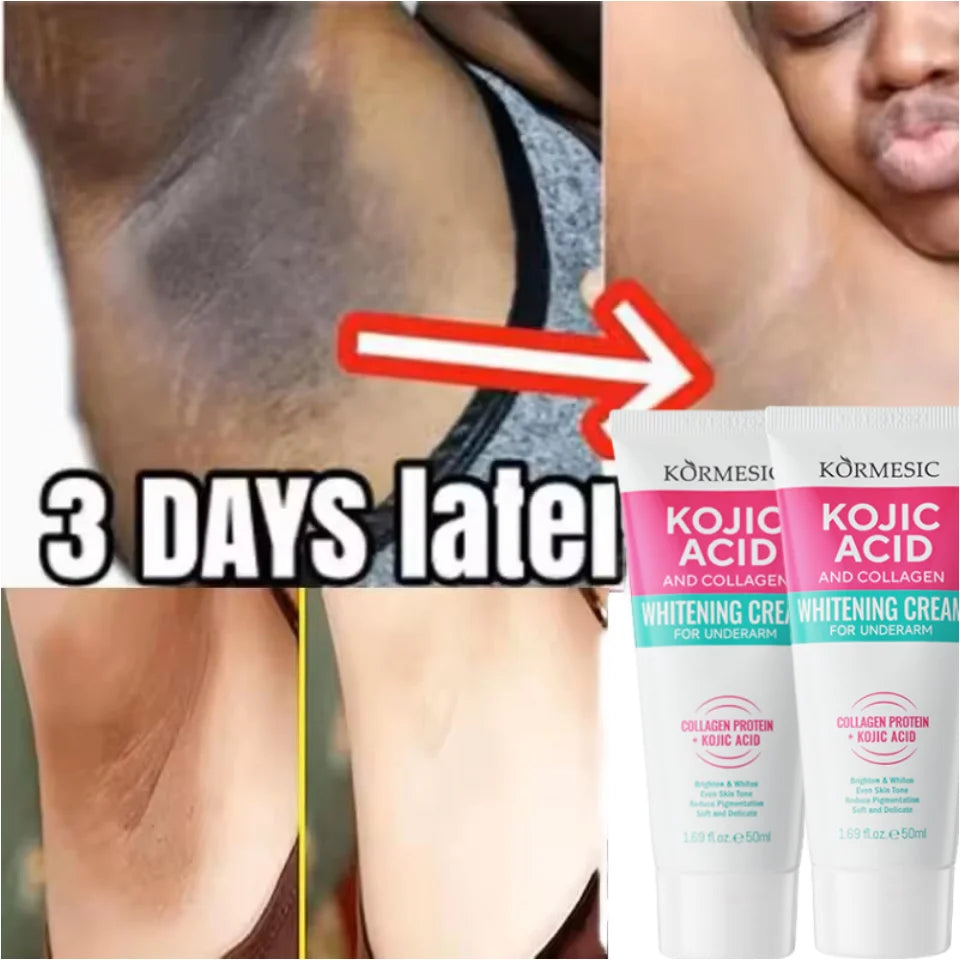 50g Body Underarm Whitening Cream Private Parts Bleaching Whiten Butt Knee Brighten Inner Thigh Intimate Dark Remove Melanin