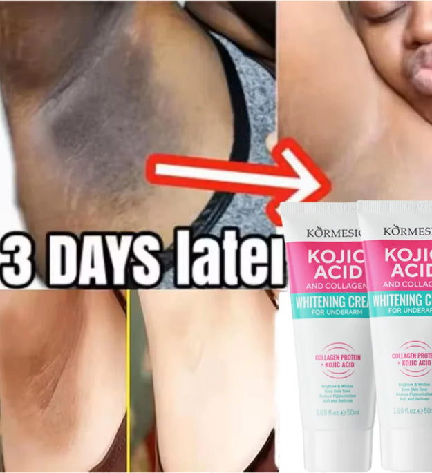 50g Body Underarm Whitening Cream Private Parts Bleaching Whiten Butt Knee Brighten Inner Thigh Intimate Dark Remove Melanin