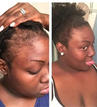 100ML Hair Shampoo For Fast Hair Growth Rosemary Onion Shampoo 30ML Spray Anti Hair Loss Effective Within 7 Day Hair Growth - BlissFully