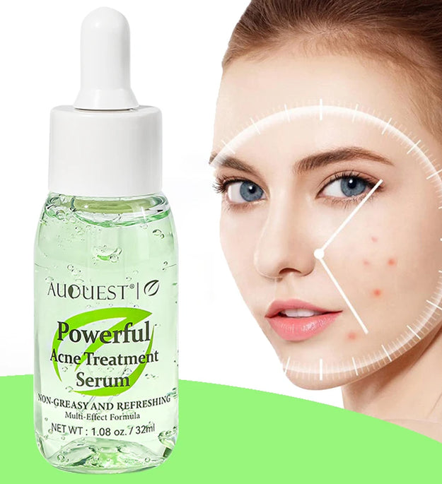 AUQUEST Herbal Acne Treatment Face Serum Salicylic Acid Oil Control Pimple Remover Facial Acne Removal Skin Care - BlissFully