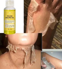 Strong Yellow Peeling Oil Bleach Dark Skin Whiten Lotion Lighten Body Elbow Knee Hand Exfoliate Dead Skin Nourish Even Skin Tone - BlissFully