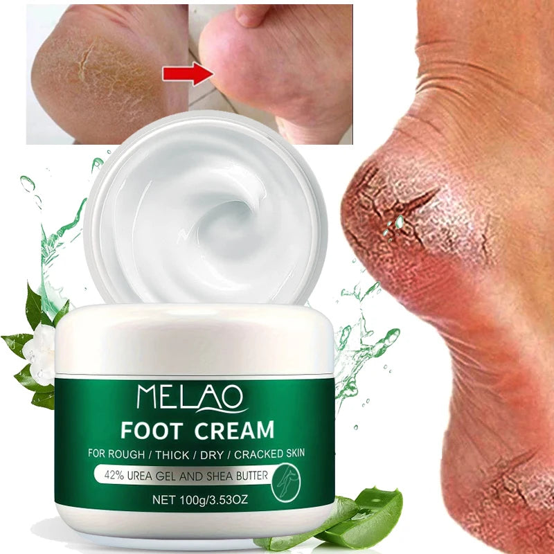 MELAO Urea Cream Salicylic Acid Foot for Dry Cracked Feet Heels Knees Hands Repair Treatment,Moisturizer Dead Skin Remover