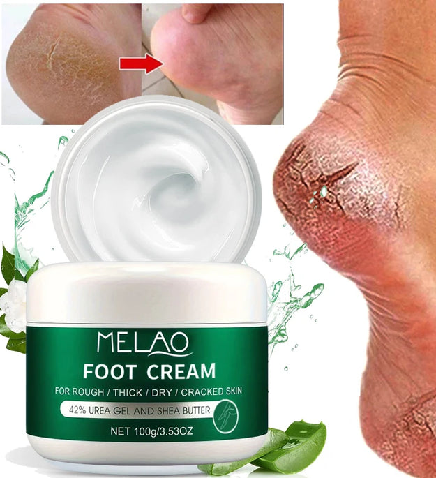 MELAO Urea Cream Salicylic Acid Foot for Dry Cracked Feet Heels Knees Hands Repair Treatment,Moisturizer Dead Skin Remover