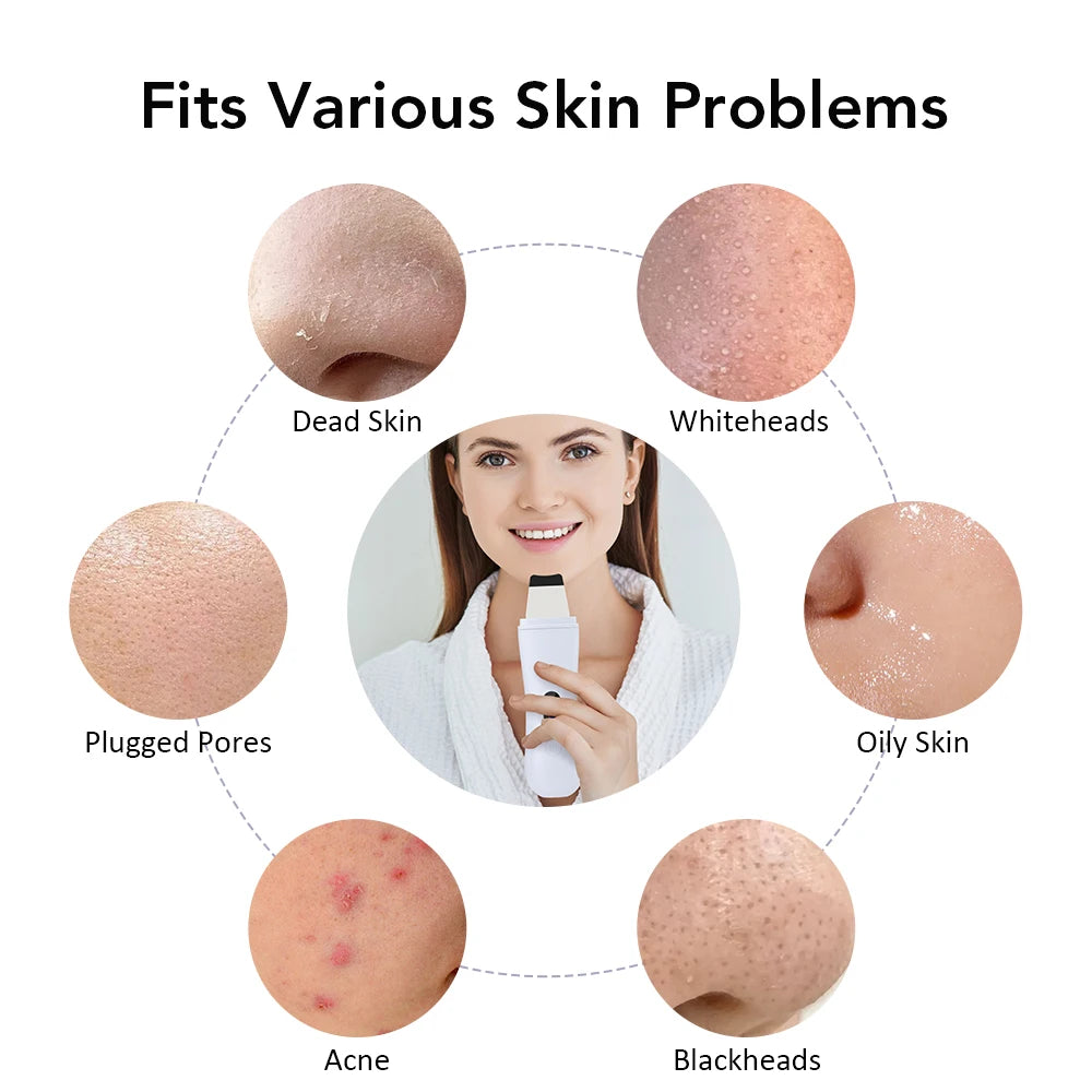 Ultrasonic Skin Scrubber Skin Spatula Ion Deep Face Cleaning 4 Modes Facial Lifting Ultrasonic Cleaner Peeling Skin Care Device - BlissFully