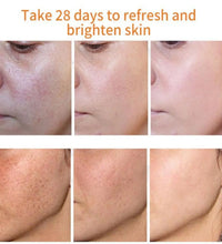 Whitening Freckles Cream Remove Melasma Dark Spot Lightening Melanin Brightening Melasma Remover Moisturize Anti-aging Face Care - BlissFully