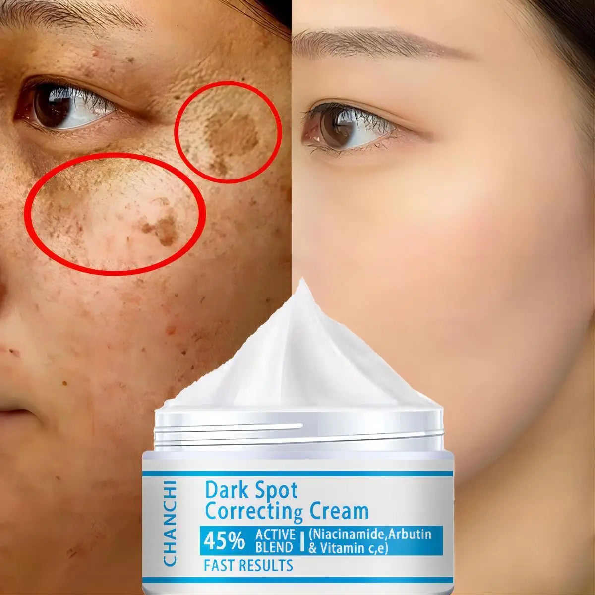 Whitening Freckles Cream Remove Melasma Dark Spot Lightening Melanin Brightening Melasma Remover Moisturize Anti-aging Face Care - BlissFully