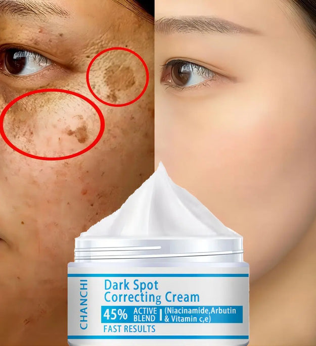 Whitening Freckles Cream Remove Melasma Dark Spot Lightening Melanin Brightening Melasma Remover Moisturize Anti-aging Face Care - BlissFully