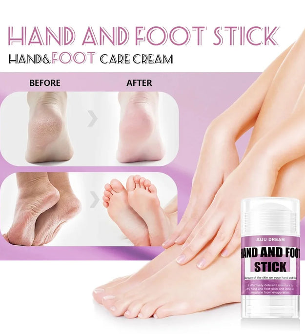 Urea Glycerin Foot & Hand Care Stick, Moisturizing Repair for Dry Cracked Skin, Gentle Formula, Long-Lasting Hydration, Unisex