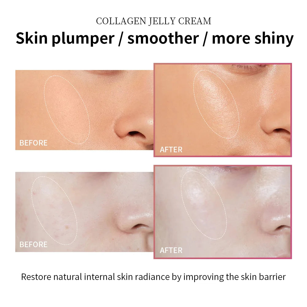 Moisturizing Collagen Jelly Cream Niacinamide Hydrolyzed Collagen Tightening Soothing Anti-Aging Firmness Hydration Skincare - BlissFully