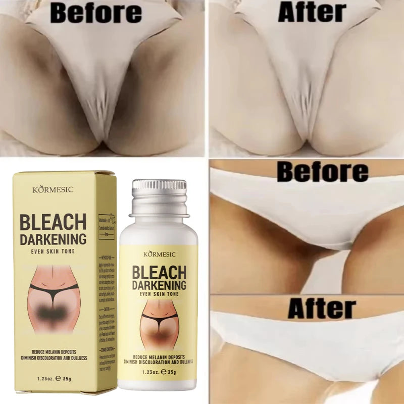 Whitening Body Cream Private Parts Underarm Bleaching Serum Whiten Butt Knee Brighten Inner Thigh Intimate Dark Remove Melanin