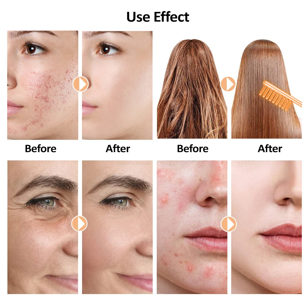 Electric Skin Therapy Wand Machine 4 In 1 Handheld Face Skin Beauty Tools for Acne Massage Skin Tightening Wrinkle Reducing