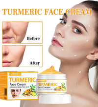 Anti Acne Turmeric Cream, Fades Scars & Dark Spots, for Oily and Dull Skin, Brightening Turmeric Face Care Treatment, 50ml - BlissFully