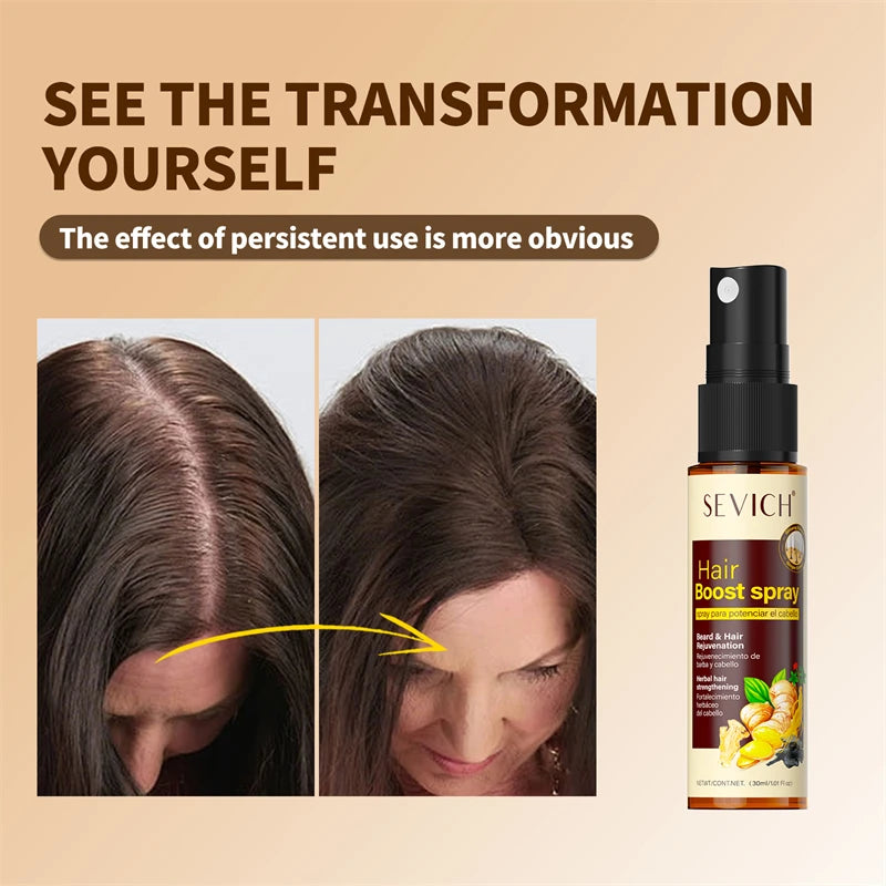 Sevich 30ml Hebal Oil Essence Fast Hair Growth Spray Hair Loss Treatment Help for hair Growth Hair Care