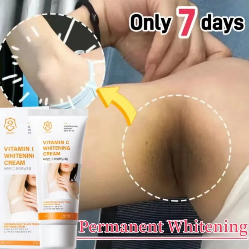 Nicotinamide Whitening Cream For Dark Skin Effective Lighten Thigh Inner Bleach Remove Melanin Private Parts Brightening Cream