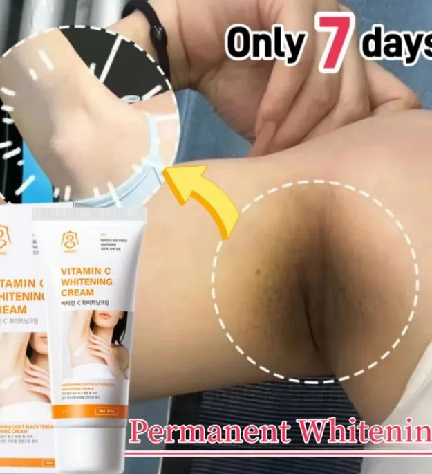 Nicotinamide Whitening Cream For Dark Skin Effective Lighten Thigh Inner Bleach Remove Melanin Private Parts Brightening Cream