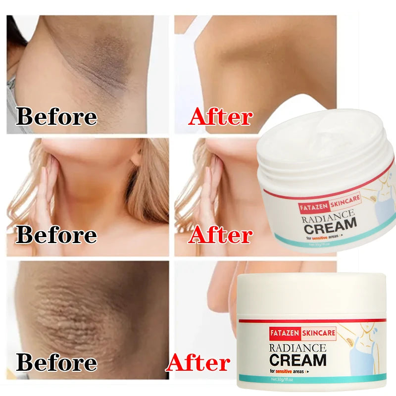 30g/1pcs Underarm Whitening Cream,Enhances Skin Radiance,Dark Spot Fading,Suitable For Inner Thighs,Armpits,Knees And Elbows