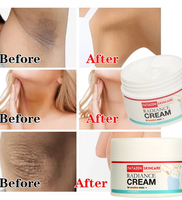 30g/1pcs Underarm Whitening Cream,Enhances Skin Radiance,Dark Spot Fading,Suitable For Inner Thighs,Armpits,Knees And Elbows